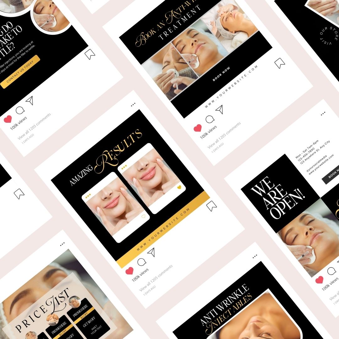 50 Black Gold Botox and Filler Instagram Posts